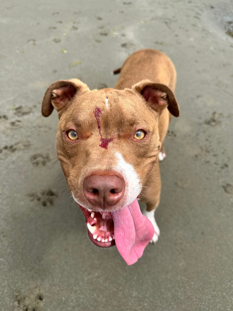 Barnacle injury at Bahobohosh Point in Washington by Happy Vegan Campers